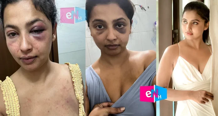 ANICKA VIJAY VIKRAMAN ACTRESS