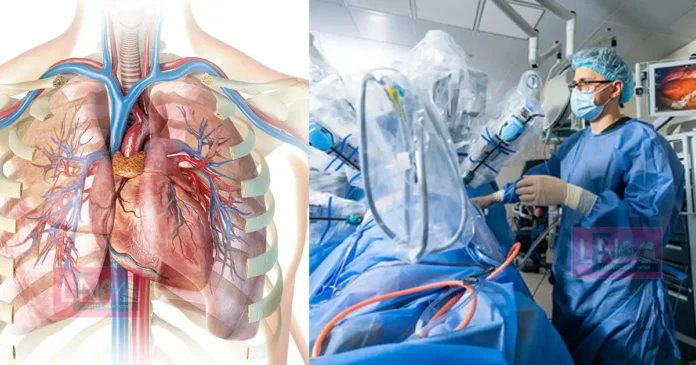 first robotic heart transplant surgery without opening the chest