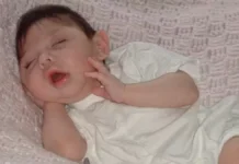 “നാല് വയസ്സിനപ്പുറം ജീവിക്കില്ല”; മസ്തിഷ്കം ഏതാണ്ട് പൂർണ്ണമായും ഇല്ലാതെ ജനിച്ച അലക്സ് 20-ാം ജന്മദിനം ആഘോഷിക്കുന്നു; അത്ഭുതമെന്ന് ലോകം