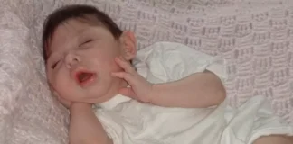 “നാല് വയസ്സിനപ്പുറം ജീവിക്കില്ല”; മസ്തിഷ്കം ഏതാണ്ട് പൂർണ്ണമായും ഇല്ലാതെ ജനിച്ച അലക്സ് 20-ാം ജന്മദിനം ആഘോഷിക്കുന്നു; അത്ഭുതമെന്ന് ലോകം