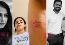 “വയറ്റിൽ ചവിട്ടി, തല നിലത്തടിച്ചു, തുടയിൽ കടിച്ചു”: മുൻ പങ്കാളിയുടെ കൊടുംക്രൂരത ചിത്രങ്ങൾ സഹിതം വെളിപ്പെടുത്തി നടി ജസീല പർവീൺ;ഒപ്പം വിഡിയോയും നിയമപോരാട്ടത്തിന് പിന്തുണ തേടുന്നു