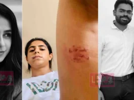 “വയറ്റിൽ ചവിട്ടി, തല നിലത്തടിച്ചു, തുടയിൽ കടിച്ചു”: മുൻ പങ്കാളിയുടെ കൊടുംക്രൂരത ചിത്രങ്ങൾ സഹിതം വെളിപ്പെടുത്തി നടി ജസീല പർവീൺ;ഒപ്പം വിഡിയോയും നിയമപോരാട്ടത്തിന് പിന്തുണ തേടുന്നു