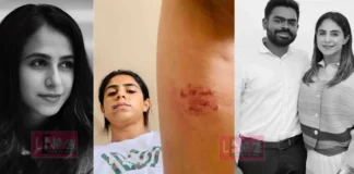 “വയറ്റിൽ ചവിട്ടി, തല നിലത്തടിച്ചു, തുടയിൽ കടിച്ചു”: മുൻ പങ്കാളിയുടെ കൊടുംക്രൂരത ചിത്രങ്ങൾ സഹിതം വെളിപ്പെടുത്തി നടി ജസീല പർവീൺ;ഒപ്പം വിഡിയോയും നിയമപോരാട്ടത്തിന് പിന്തുണ തേടുന്നു