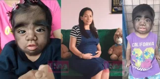 ഗർഭിണിയായിരിക്കെ താൻ ചെയ്ത ആ തെറ്റാണോ , മകൻ ‘മൃഗങ്ങളെ പോലെ ശരീരം മുഴുവൻ രോമമുള്ളവനായി ജനിച്ചത് എന്ന് ഒരമ്മ ? അമ്മയുടെ കണ്ണീരിനും കുറ്റബോധത്തിനും ഒടുവിൽ ശാസ്ത്രത്തിന്റെ മറുപടി