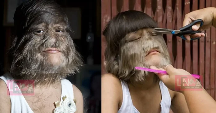 worlds-hairiest-girl-completely-shaven-her-body