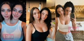 ഇന്റർനെറ്റിനെ ഞെട്ടിച്ച ഒറ്റ ഉടലും രണ്ട് തലയും ഉള്ള ഇൻസ്റ്റഗ്രാമിലെ ‘വൈറൽ’ സഹോദരിമാരെ കുറിച്ചുള്ള ഞെട്ടിക്കുന്ന വിവരങ്ങൾ