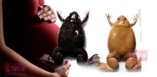 ഒരു സ്ത്രീ ഗർഭിണിയാണോ എന്നറിയാൻ 1950-കളിലെഡോക്ടർമാർ തവളകളെ ഉപയോഗിച്ചിരുന്നു; ആ വിചിത്ര രീതി! നൂറു ശതമാനം കൃത്യതയുള്ളതും ശാസ്ത്രീയവുമായിരുന്നു. എങ്ങനെയെന്നറിയേണ്ടേ ?