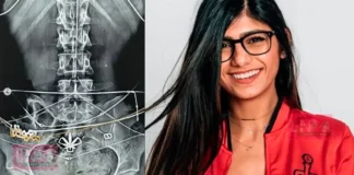 പോ@ൺ താരമെന്ന ഭൂതകാലം മായ്ക്കാൻ മിയ ഖലീഫ; ന#ഗ്ന#തയ്ക്ക് പുതിയ അർത്ഥം നൽകി ശരീരത്തിന്റെ എക്സ്-റേ ചിത്രങ്ങൾ!