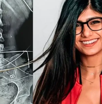 പോ@ൺ താരമെന്ന ഭൂതകാലം മായ്ക്കാൻ മിയ ഖലീഫ; ന#ഗ്ന#തയ്ക്ക് പുതിയ അർത്ഥം നൽകി ശരീരത്തിന്റെ എക്സ്-റേ ചിത്രങ്ങൾ!