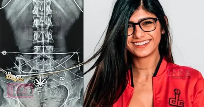 mia x ray photoshoot