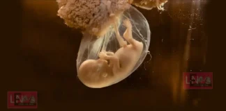 ഒരാളുടെ ജനിക്കാതെ പോയ ഇരട്ടസഹോദരൻ അയാളുടെ മകന്റെ അച്ഛനായി! വൈദ്യശാസ്ത്രത്തെയും ലോകത്തെയും അമ്പരപ്പിച്ച ഒരു ഡിഎൻഎ പരിശോധനാ ഫലം