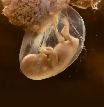 ഒരാളുടെ ജനിക്കാതെ പോയ ഇരട്ടസഹോദരൻ അയാളുടെ മകന്റെ അച്ഛനായി! വൈദ്യശാസ്ത്രത്തെയും ലോകത്തെയും അമ്പരപ്പിച്ച ഒരു ഡിഎൻഎ പരിശോധനാ ഫലം