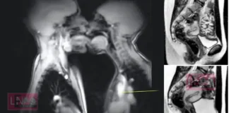 എം.ആർ.ഐ സ്കാനറിനുള്ളിൽ ദമ്പതികളുടെ ലൈം#ഗികബന്ധം; ശരീരശാസ്ത്രത്തെ മാറ്റിയെഴുതിയ വിചിത്രമായ പരീക്ഷണം