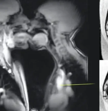 എം.ആർ.ഐ സ്കാനറിനുള്ളിൽ ദമ്പതികളുടെ ലൈം#ഗികബന്ധം; ശരീരശാസ്ത്രത്തെ മാറ്റിയെഴുതിയ വിചിത്രമായ പരീക്ഷണം