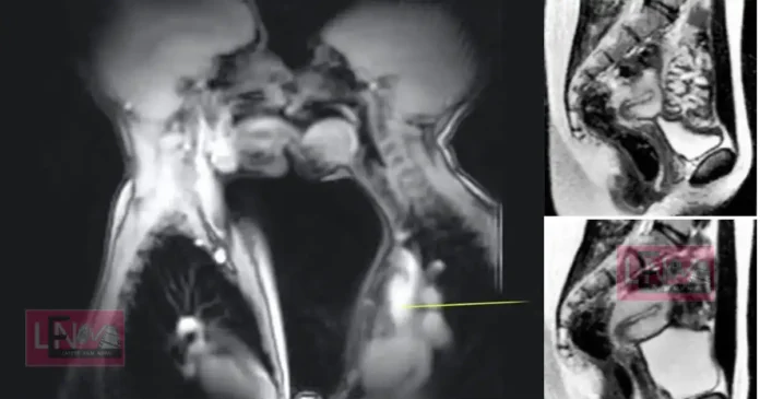 mri mechine intimacy